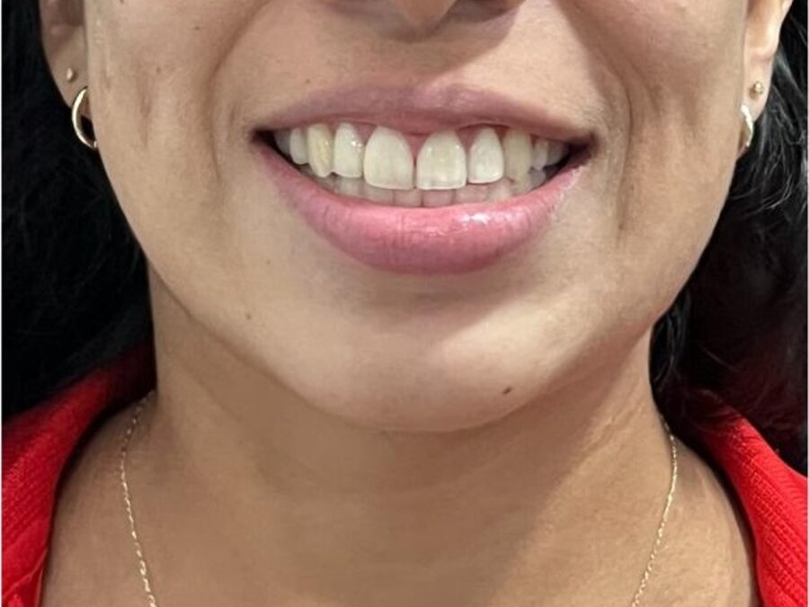 Orthodontics — After